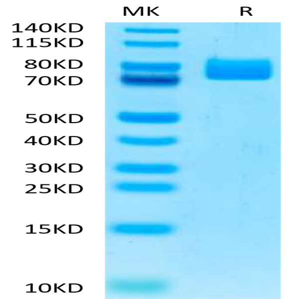 Human MADCAM1 Protein (MCM-HM201)