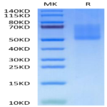 Biotinylated Human MADCAM1 Protein (MCM-HM401B)