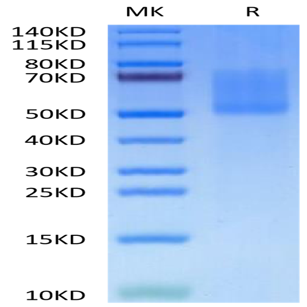 Biotinylated Human MADCAM1 Protein (MCM-HM401B)