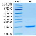Cynomolgus MCP-1/CCL2 Protein (MCP-CM101)