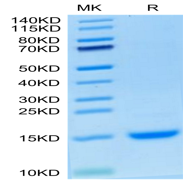 Cynomolgus MCP-1/CCL2 Protein (MCP-CM101)