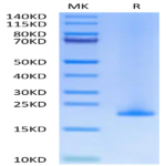 Human MD2 Protein BP003493 Syd Labs