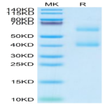 Mouse MEPE Protein BP004874 Syd Labs