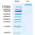Human HLA-A*11