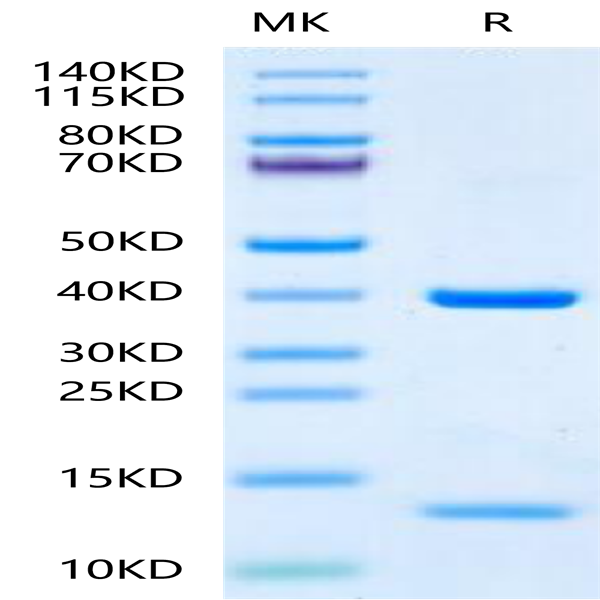 Human HLA-A*11