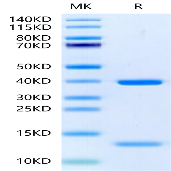 Human HLA-A*11