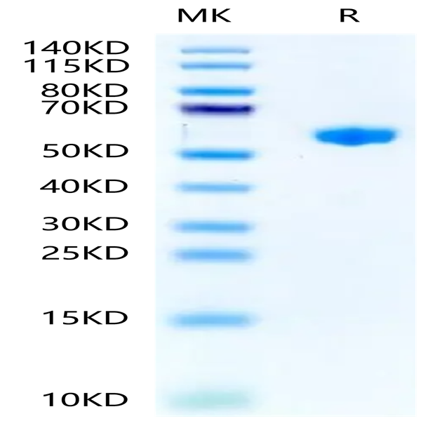 Mouse H-2K (b) &B2M&OVA (SIINFEKL) Monomer Protein (MHC-MM453)