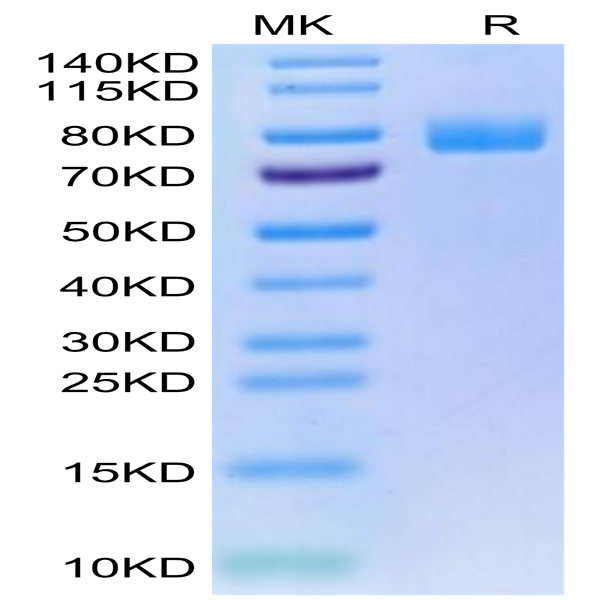 Human MICA Protein (MIC-HM20A)