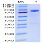 Human MICB Protein (MIC-HM20B)