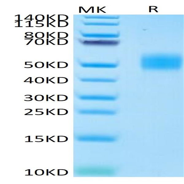 Human MICB Protein (MIC-HM40B)