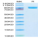 Mouse CD10/MME Protein (MME-MM110)