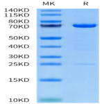 Human MMP-2 Protein BP004375 Syd Labs