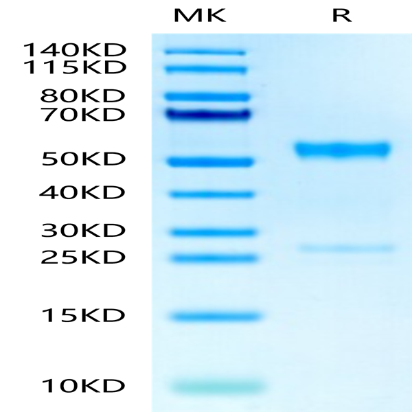 Human MMP-8 Protein (MMP-HM108)