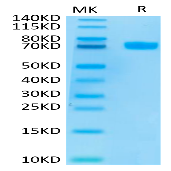 Human MSLN/Mesothelin Protein (MSL-HM280)