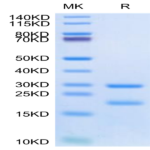 Human MASP2 Protein (MSP-HE102)