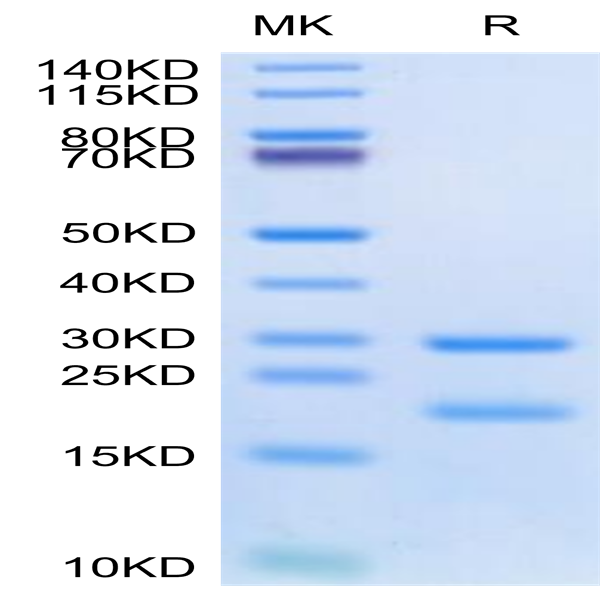 Human MASP2 Protein (MSP-HE102)