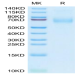 Human MSR1 Protein (MSR-HM101)