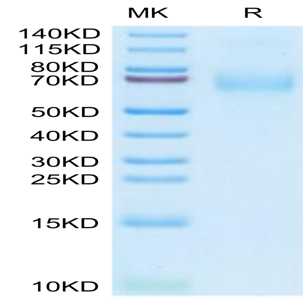 Human MSR1 Protein (MSR-HM101)