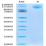 Human CA125/MUC16 Protein (MUC-HM126)