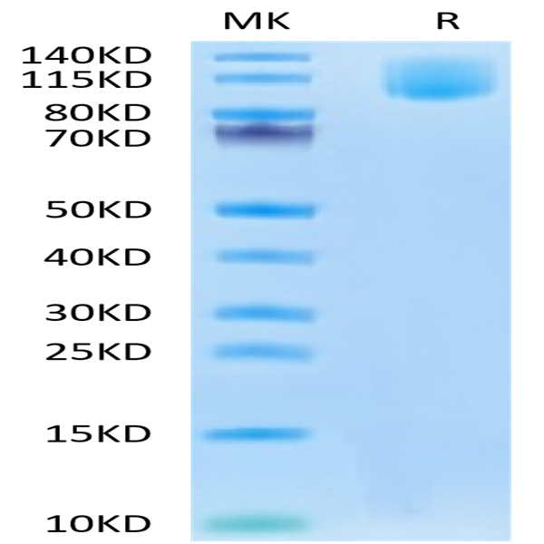 Human CA125/MUC16 Protein (MUC-HM126)