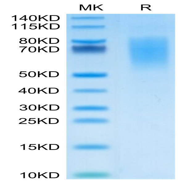 Human CA125/MUC16 Protein (MUC-HM416)
