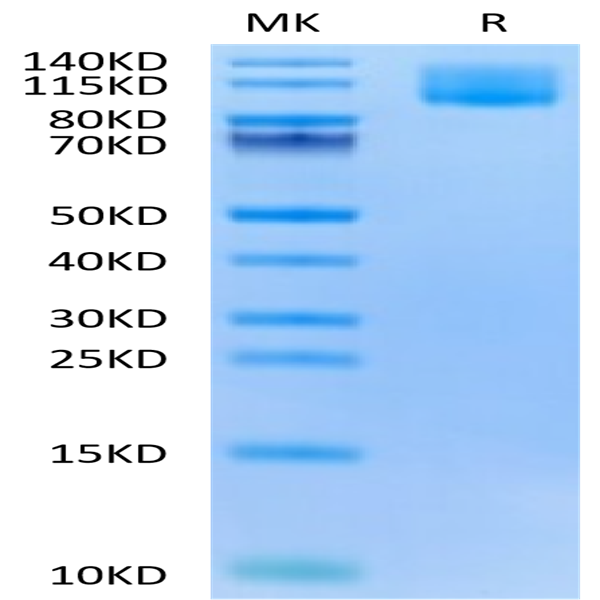Biotinylated Human CA125/MUC16 Protein (MUC-HM426B)