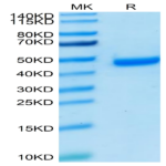 Human Nectin-4 Protein (NEC-HM404)
