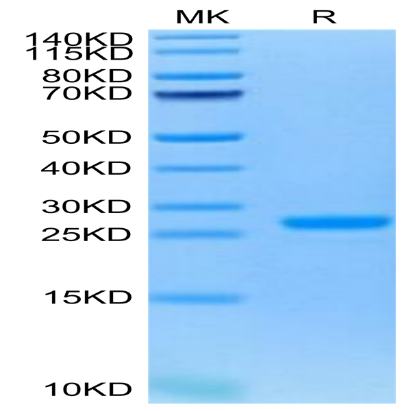 Human NGAL/Lipocalin-2 Protein (NGL-HM102)
