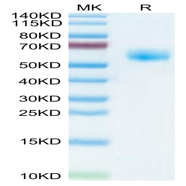 Human NKG2A&CD94 Protein (NKC-HM295)