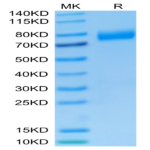 Human NKG2A&CD94 Protein (NKC-HM394)