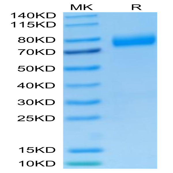 Human NKG2A&CD94 Protein (NKC-HM394)
