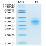 Human NKG2C&CD94 Protein (NKC-HM696)