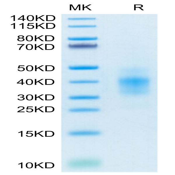 Human NKG2C&CD94 Protein (NKC-HM696)