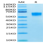 Human NKG2D/CD314 Protein (NKG-HM22D)