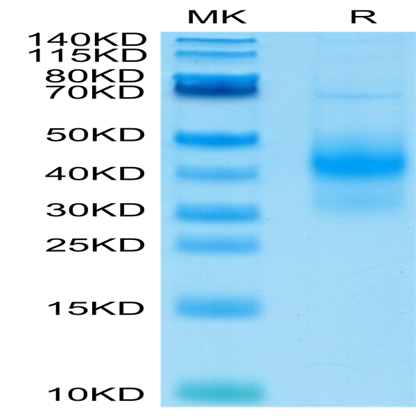 Human NKG2D/CD314 Protein (NKG-HM42D)
