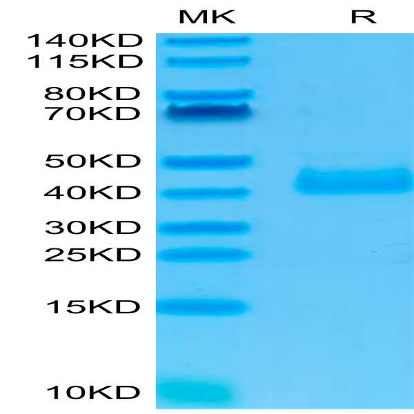 Human NKp46/NCR1/CD335 Protein (NKP-HM146)