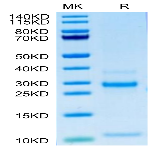 Human Notch 3 Protein (NOT-HM103)