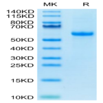 Biotinylated Human Notch 3 Protein (NOT-HM403B)