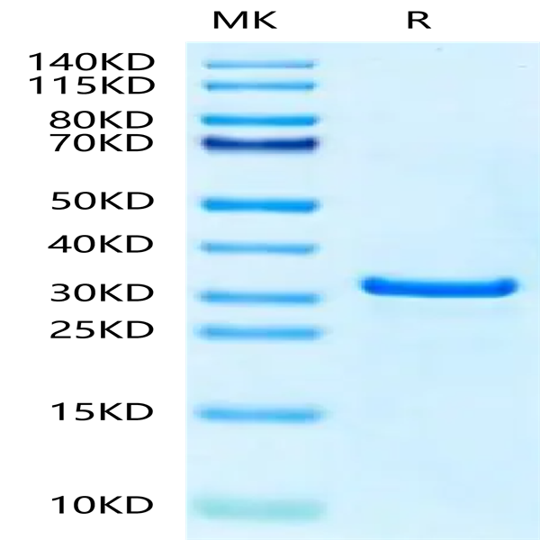 Human NUDT5 Protein (NUD-HE1T5)