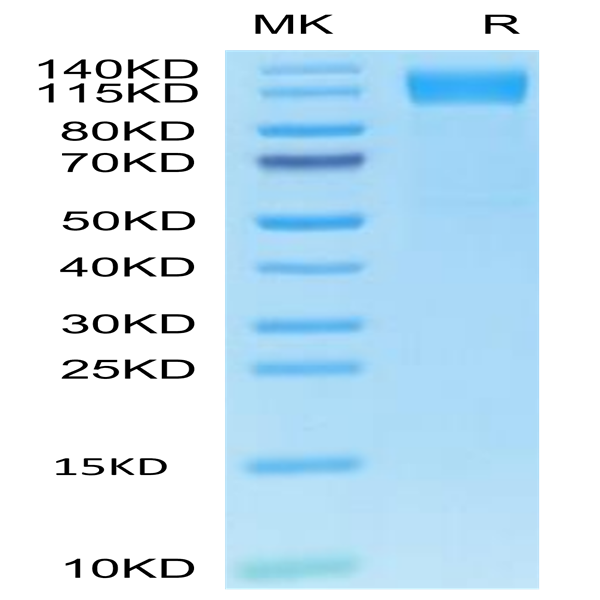 Human OSMR&GP130 Protein (OGC-HM10R)