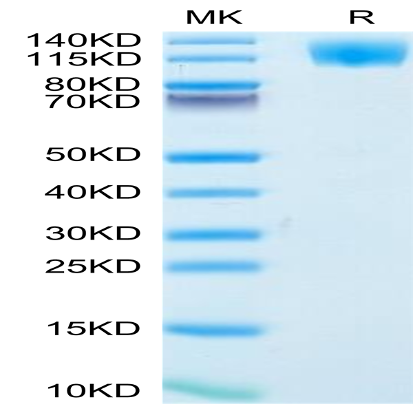 Human OSMR Protein (OSM-HM101)