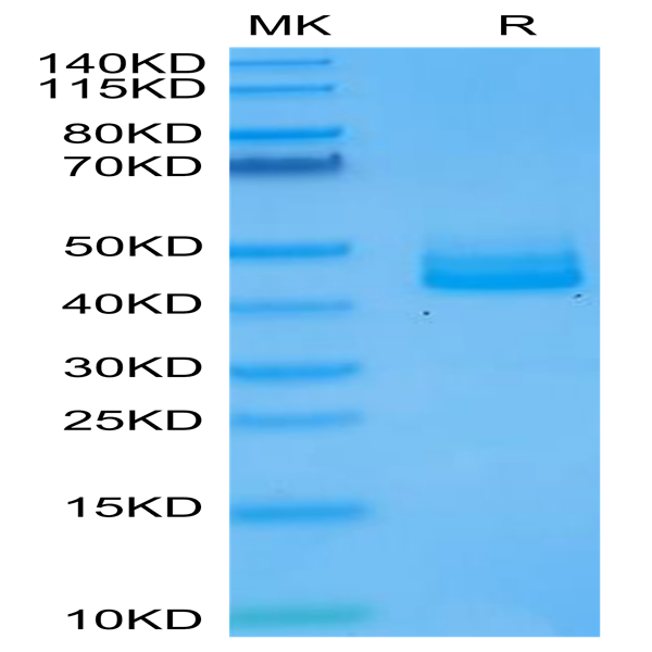 Human IL-12B/p40/NKSF2 Protein (P40-HM112)