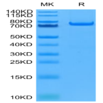 Human PADI4 Protein BP004134 Syd Labs