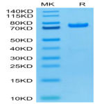 Biotinylated Human PADI4 Protein (Primary Amine Labeling) BP003970 Syd Labs