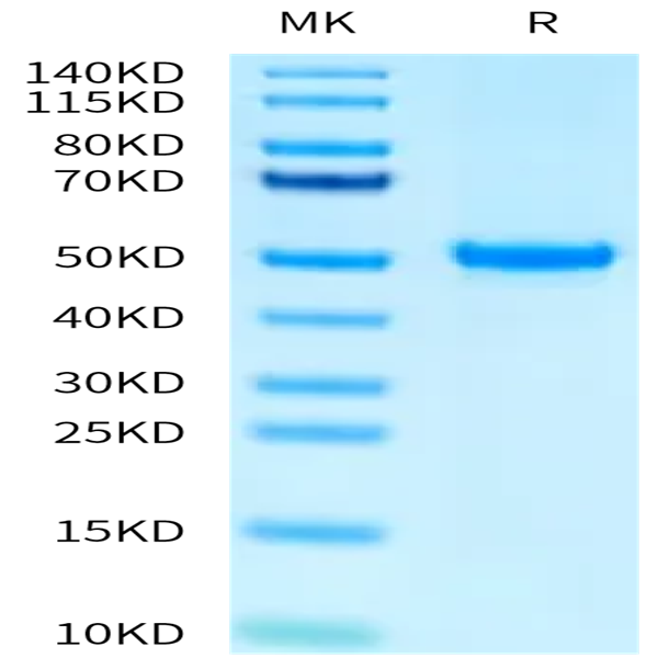 Human PAH (D415N) Protein (PAH-HB001)