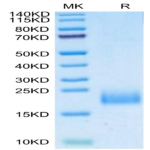 Human uPAR/PLAUR Domain 1 Protein (PAR-HM1D1)