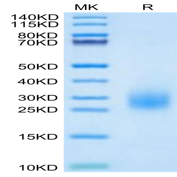 Human uPAR/PLAUR Domain 3 Potein (PAR-HM1D3)