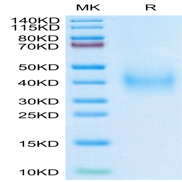 Human uPAR/PLAUR Domain (2+3) Potein (PAR-HM1D4)