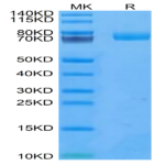 Human uPAR/PLAUR Protein (PAR-HM201)