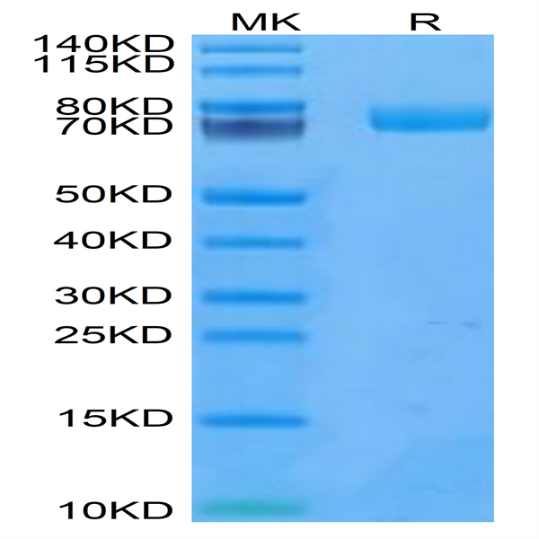 Human uPAR/PLAUR Protein (PAR-HM201)